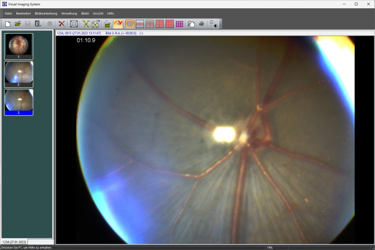 The retina of a mouse imaged with RCrodent-M